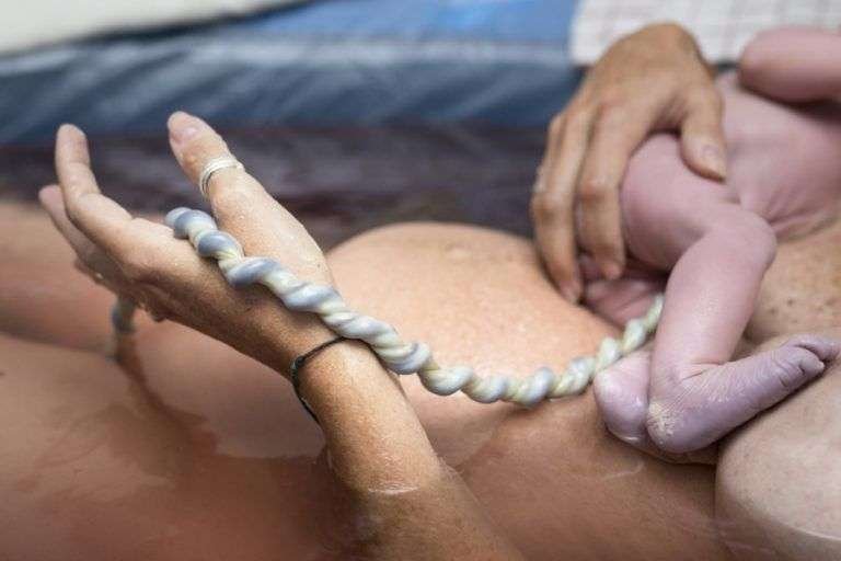 cordon umbilical