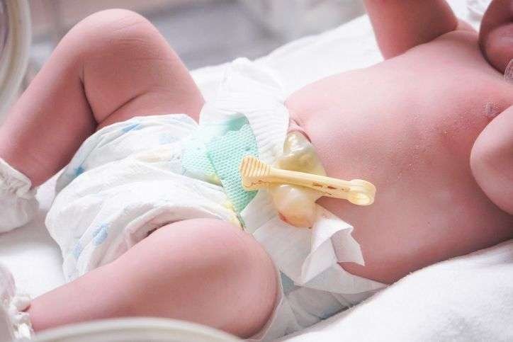 como cuidar el cordon umbilical